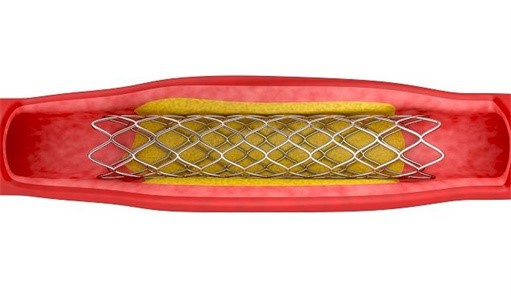 nitinol wire0.3mm nitinol wire0.3mm